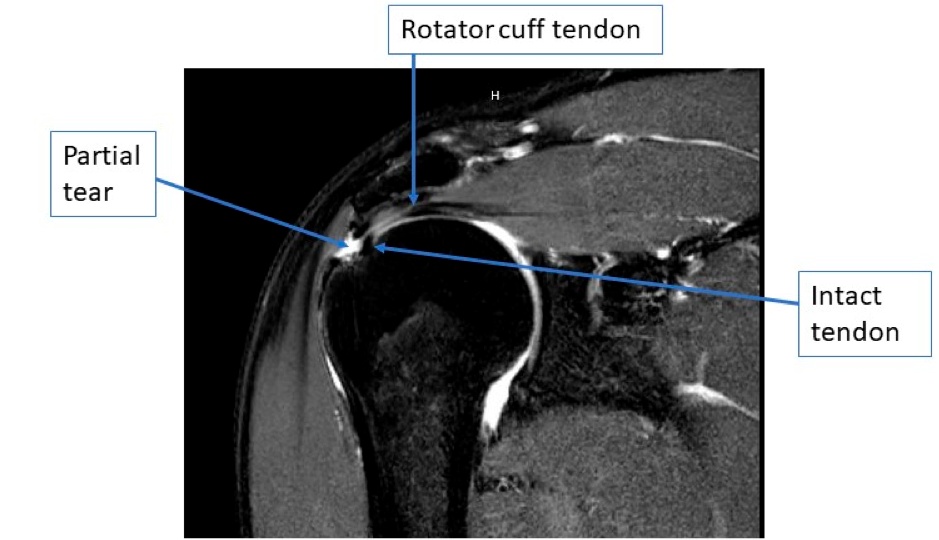 PASTA MRI